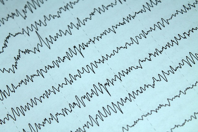 Moje zmagania z implementacją własnego układu FPGA do analizy sygnałów biologicznych w warunkach domowych - 5 2025